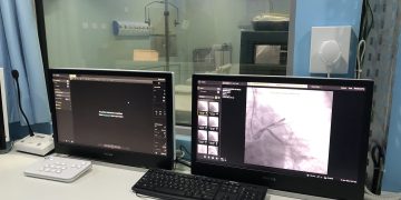 Hospital Metropolitano possui mais moderno aparelho de hemodinâmica da Paraíba disponibilizado ao SUS