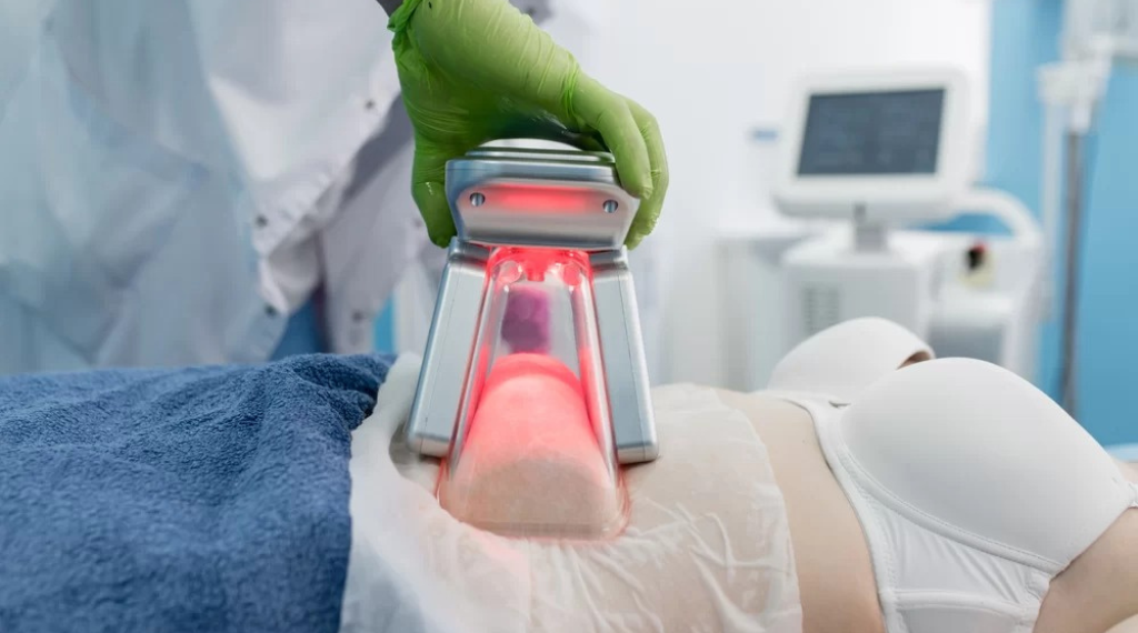 Verão aumenta em 50% procura por criolipólise em clínicas de João Pessoa