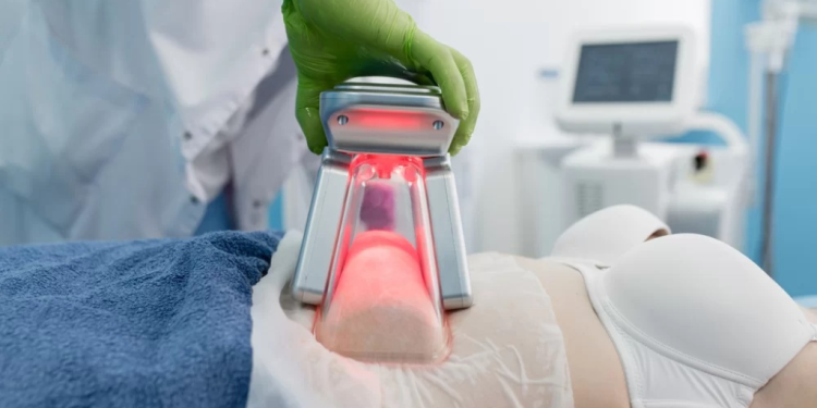 Verão aumenta em 50% procura por criolipólise em clínicas de João Pessoa